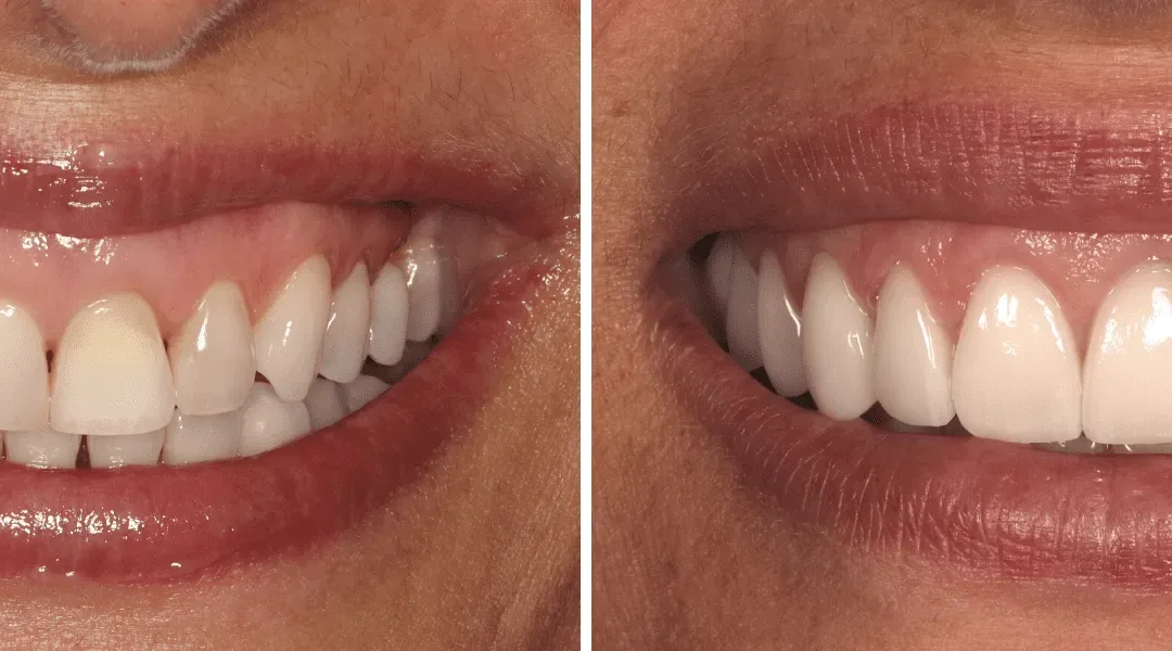 Caso Clínico — Harmonização Facial, Periodontologia, Implantologia e Dentisteria