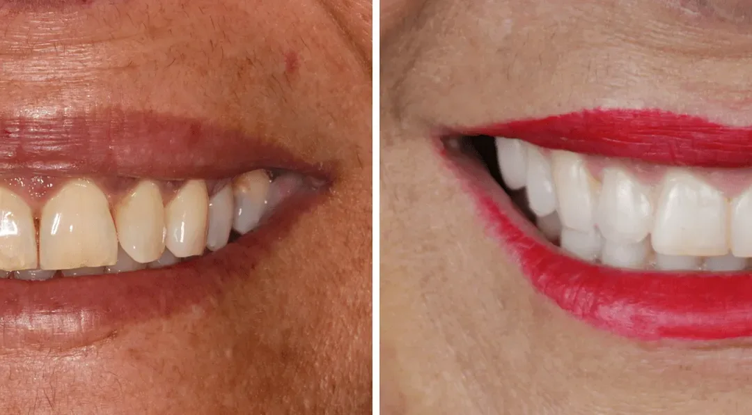 Caso Clínico — Cirurgia Oral, Endodontia, Dentisteria e Harmonização Facial