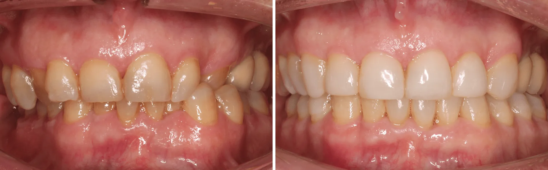 #13 Ortodontia, Dentisteria e Implantologia