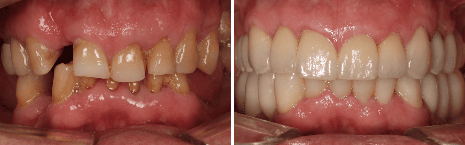 2 you clínica dentária-reabilitação fixa e implantologia
