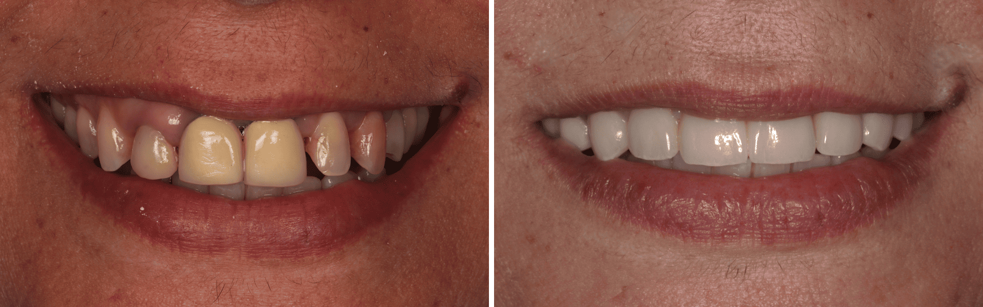 you clínica dentária-dentisteria-ortodontia-implantologia-reabilitação Fixa Dentisteria, Ortodontia, Implantologia e Reabilitação Fixa