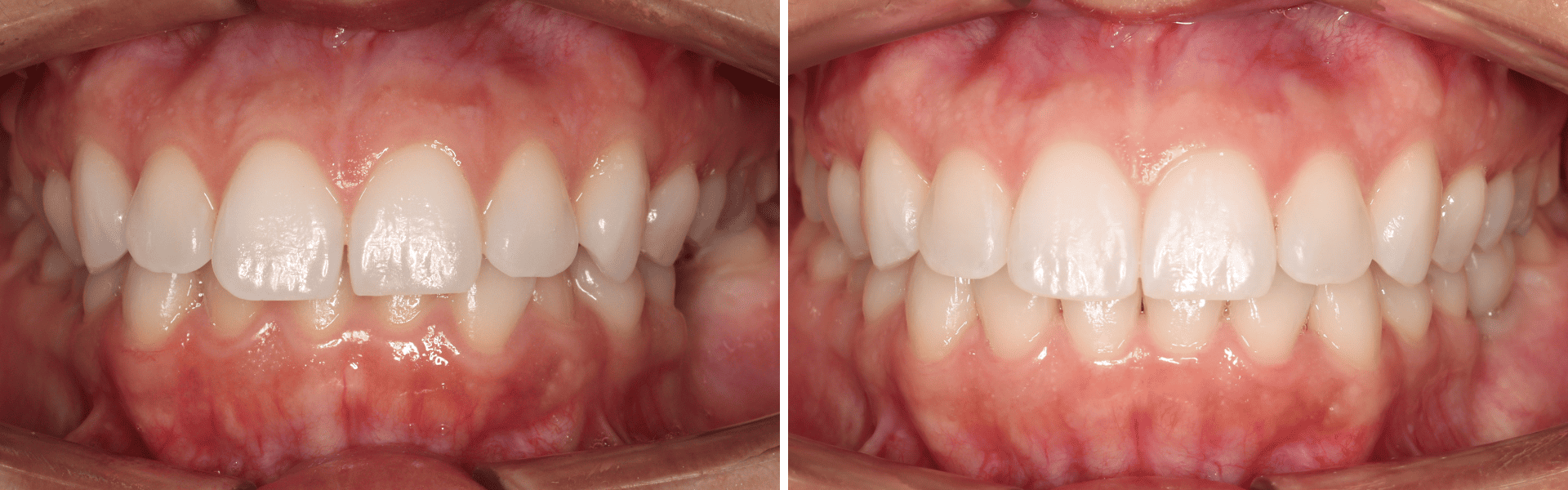 you clínica dentária-dentisteriaortodontia-implantologia Dentisteria, ortodontia e implantologia