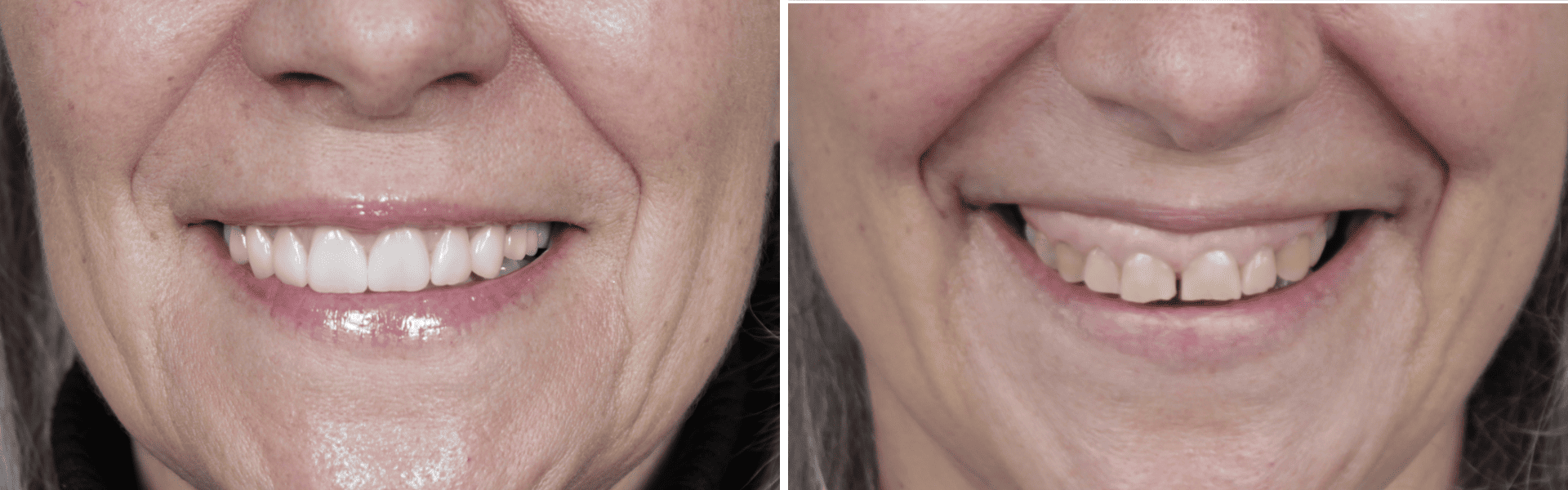 you clínica dentária-implantologia e reabilitação fixa Reabilitação fixa e implantologia